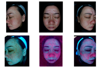 Seoulogy S5 AI semi 3D Skin Analysis System for Professional Clinics, professional Korean skincare