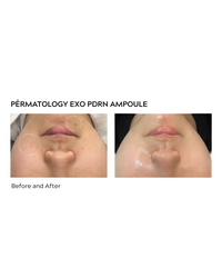 Seoulogy Permatology EXO-PDRN Recovery Ampoule, professional Korean skincare
