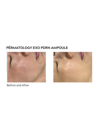 Seoulogy Permatology EXO-PDRN Recovery Ampoule, professional Korean skincare — view 2