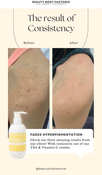 Seoulogy Beauty body factory Tranexamic Acid and Vitamin C body lotion, professional Korean skincare — view 2