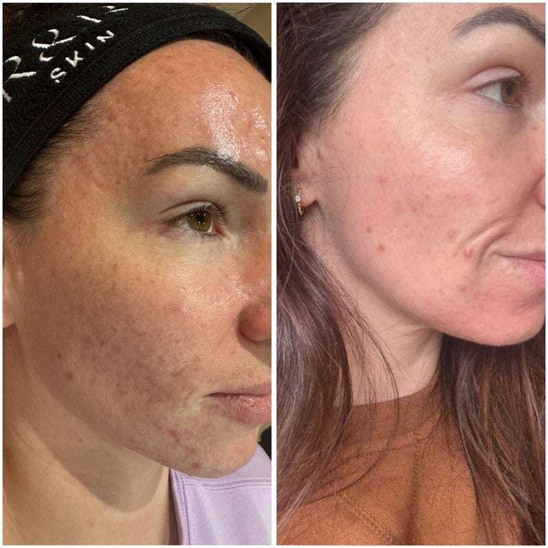 Before & after