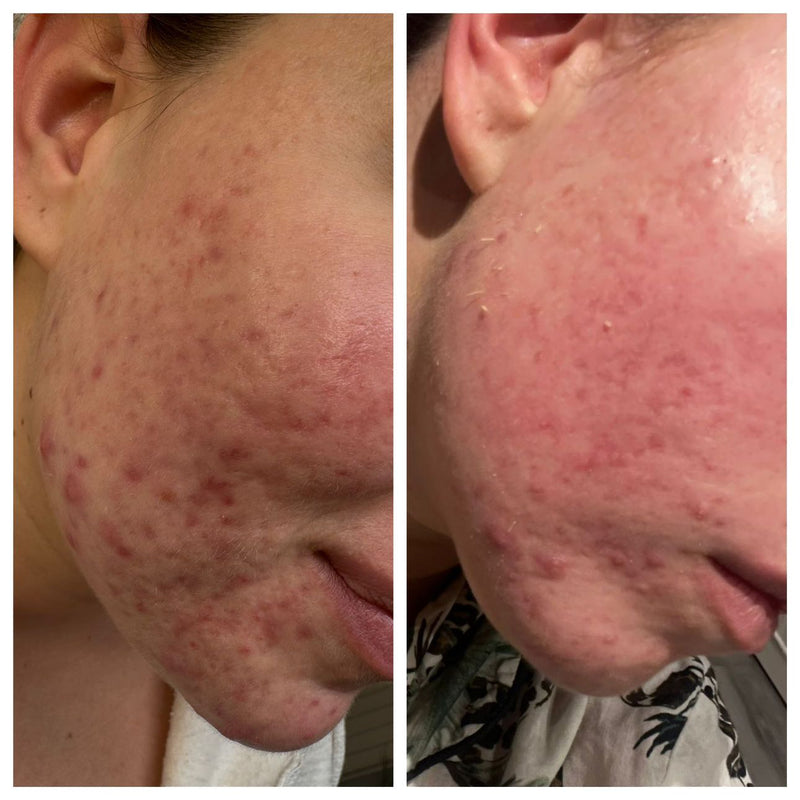 Before & after