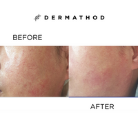 Dermathod Derma Level 345 Radiance Ampoule