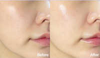 Seoulogy Dermathod Priming Peel Pads, professional Korean skincare — view 6