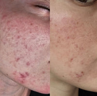 Seoulogy Illumin Biphasic Peel, professional Korean skincare — view 2