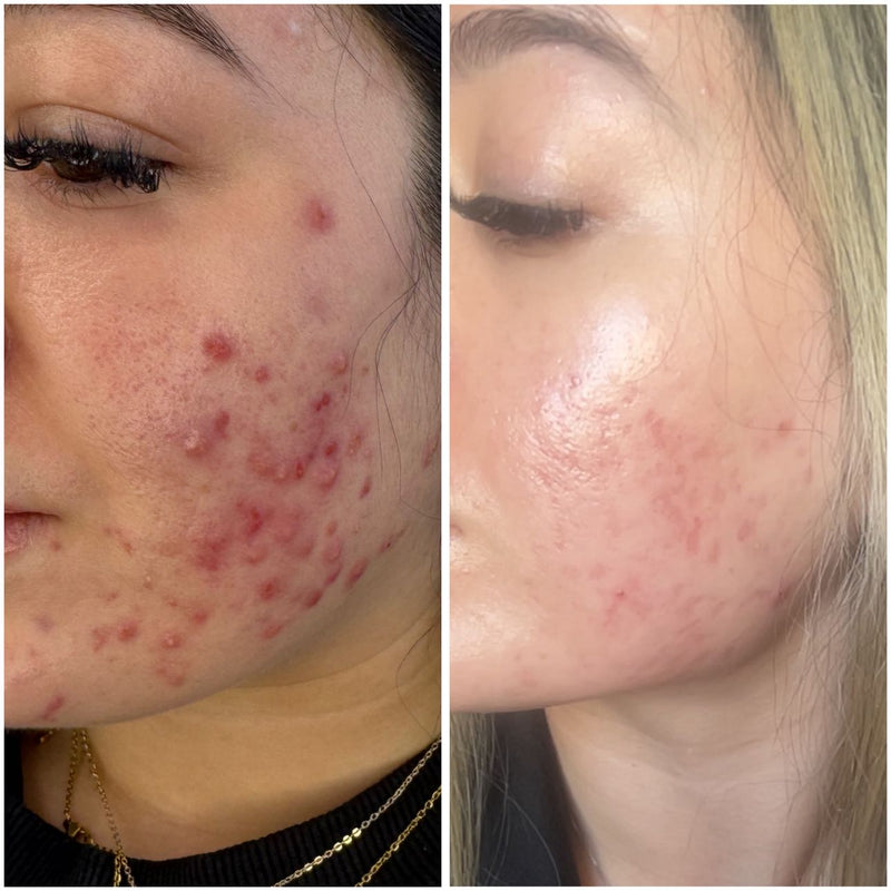 Before & after
