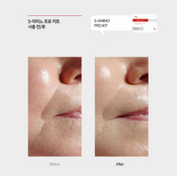 Seoulogy ISOV S-Amino Pro Kit, professional Korean skincare — view 2