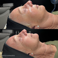 Seoulogy KRX VTox Lift Mask, professional Korean skincare — view 3