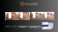 Seoulogy Eclado REJUVEN Lifting Treatment, professional Korean skincare — view 2