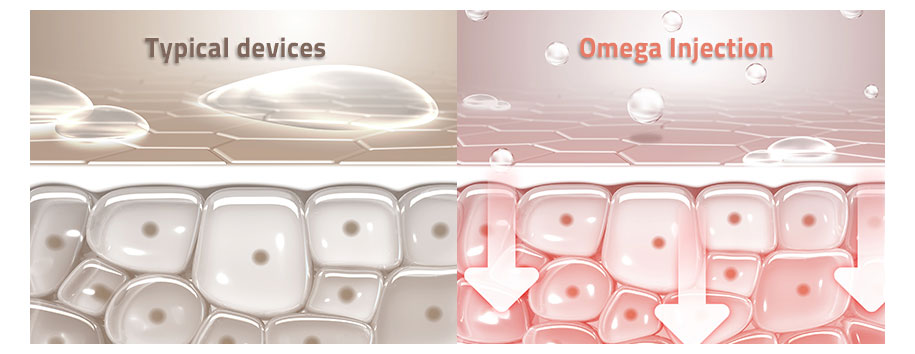 Omega Plastic Injection Wholesale distributor specializing in Korean Professional Products ...