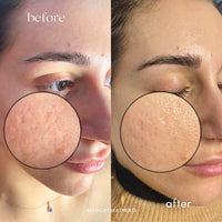 Seoulogy Krx Salmon DNA Meso Booster Ampoule, professional Korean skincare — view 4