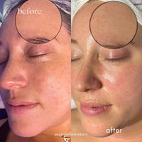 Seoulogy Krx Salmon DNA Meso Booster Ampoule, professional Korean skincare — view 3