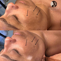 Seoulogy Krx LaZer Peel, professional Korean skincare — view 2