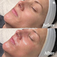 Seoulogy KRX VTox Lift Mask, professional Korean skincare — view 4