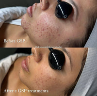 Seoulogy Krx Green Sea Peel, professional Korean skincare — view 6