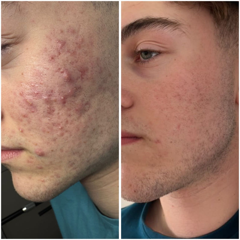 Before & after