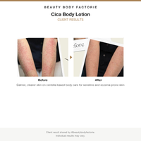 Beauty Body Factorie Cica Body Lotion before and after results card