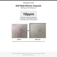Dermathod EGF Multi Effector Ampoule test results with before and after, 10ppm EGF