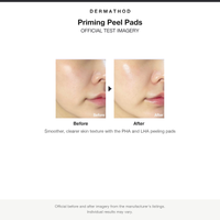 Dermathod Priming Peel Pads before and after results card