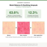 FLEXKIN G-Soothing Ampoule clinical trial results: 63.6% reduction in induced redness, before and after images