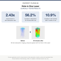 FLEXKIN Hole in One Laser clinical trial results: 2.43x skin absorption improvement, Korea Institute of Dermatology