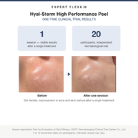 FLEXKIN Hyal-Storm Peel clinical trial results with before and after, OATC Dermatological Clinical Trial Center