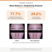 FLEXKIN L-Brightening Ampoule clinical trial results: 77.7% improvement in radiance, before and after photos