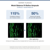 FLEXKIN R-Refine Ampoule clinical trial results: 115% increase in skin moisture, ultrasound before and after