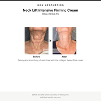 KRX Neck Lift Intensive Firming Cream before and after results card