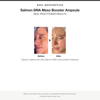 KRX Salmon DNA Meso Booster Ampoule before and after results card
