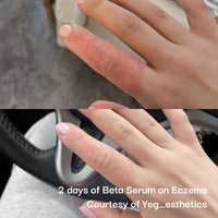 Seoulogy Neogenesis Beta Glucan serum, professional Korean skincare — view 2