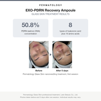Permatology EXO-PDRN Recovery Ampoule Glass Skin treatment before and after results