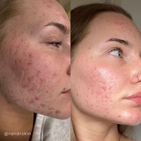 Seoulogy Krx Green Sea Peel, professional Korean skincare — view 4