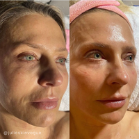 Seoulogy KRX VTox Lift Mask, professional Korean skincare — view 5