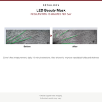 LED Beauty Mask before and after results card, crow's feet improvement